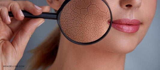 Here Are 3 Keys to Solve Dry Skin - MyAdelline